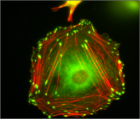 Vinculin Containing Focal Adhesions and Actin Stress Fibers in a Fibroblast-like Cell