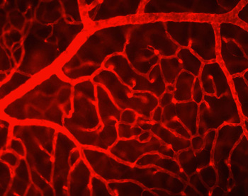 Collagen IV staining to visualize the mouse retinal vasculature.